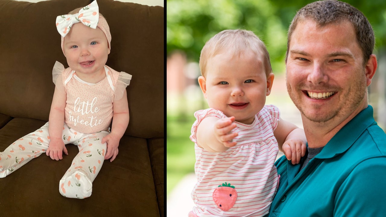 1-Year-Old and Her Dad Both Survive Craniosynostosis, a Rare Brain Condition, 29 Years Apart