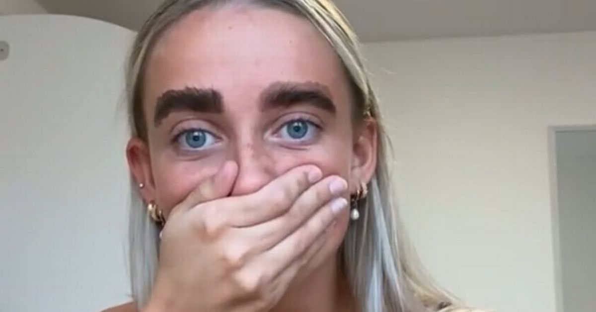 Eyebrow-Dye Leaves a woman with Massive Caterpillar Eye-Brows