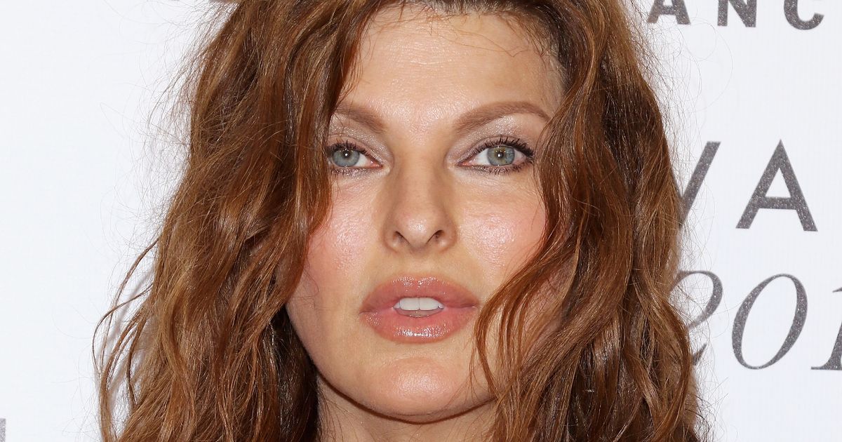 Model Linda Evangelista claims she’s ‘permanently deformed’ after cosmetic procedure