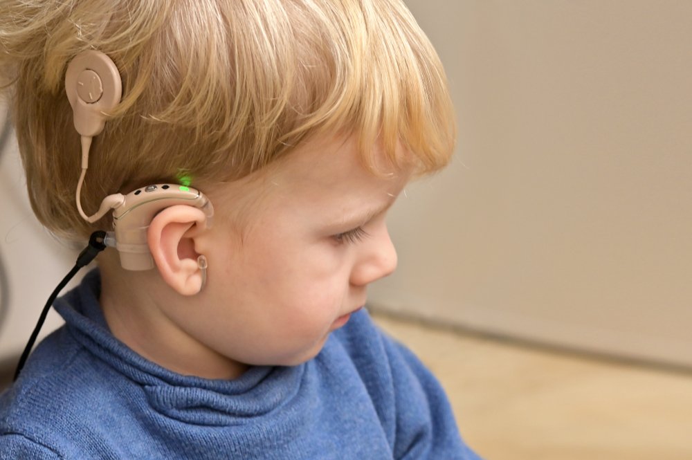 They fitted him Richard a Cochlear implant.| Source: Shutterstock