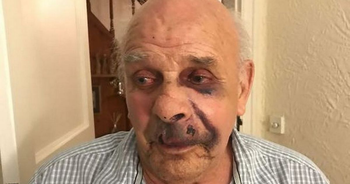 ‘I thought I’d die on my bedroom floor’ – OAP tells of brutal attack by intruders