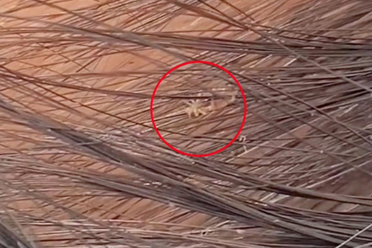 Beautician horrified as she spots LICE in her client’s hair during eyelash treatment