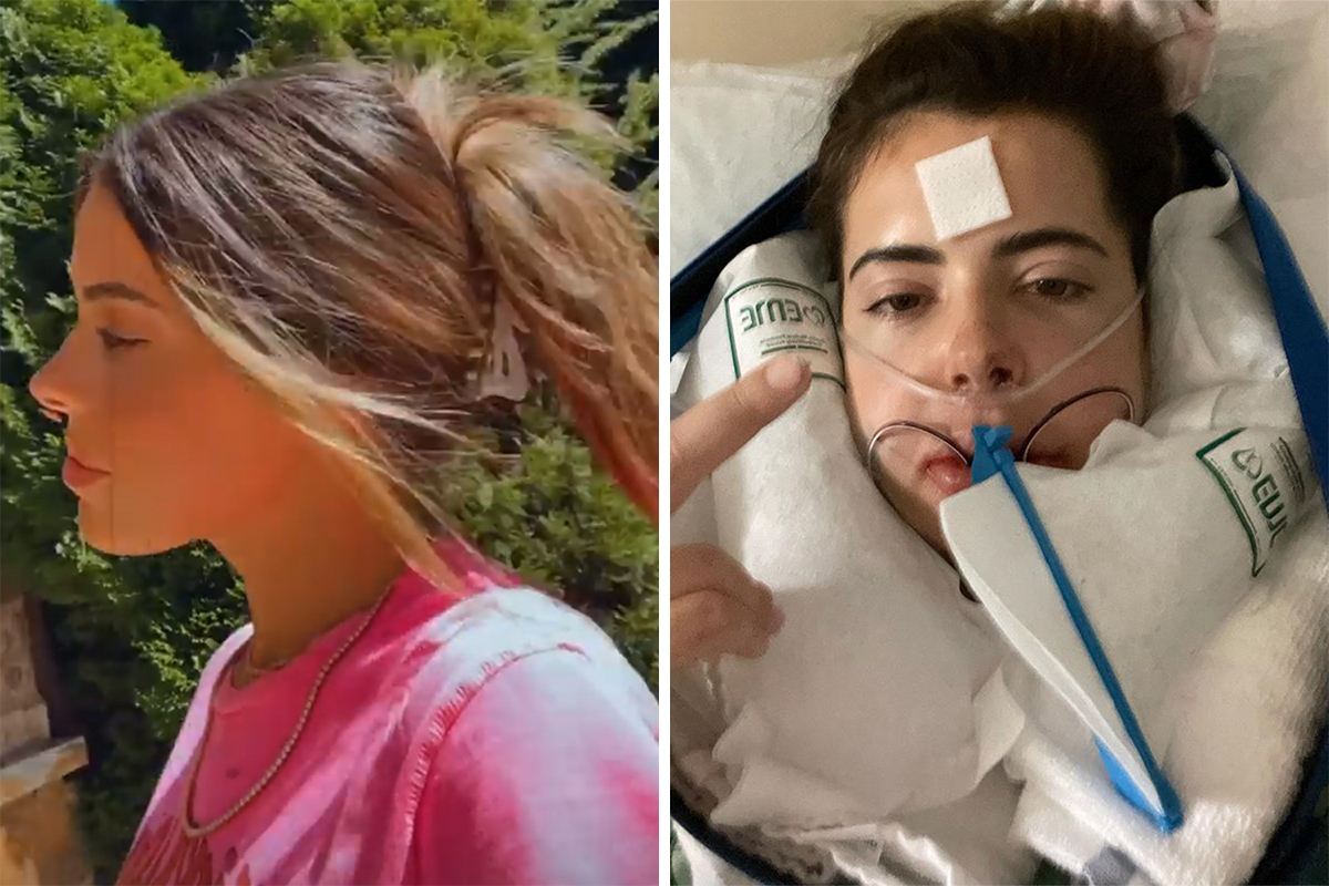 Brielle Biermann shows off her ‘side profile’ in a new clip after having double jaw surgery & sharing shocking pics