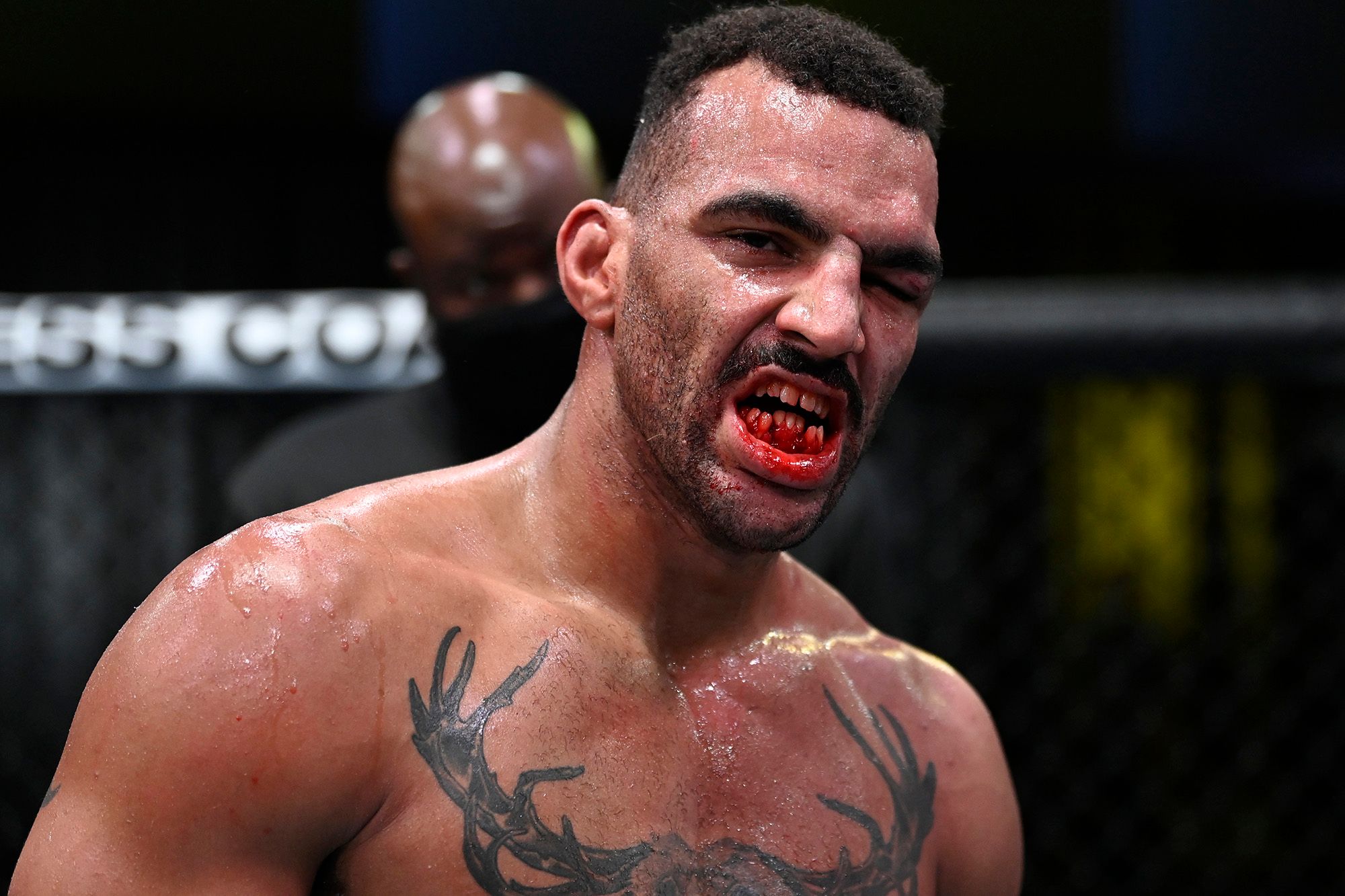 Devin Clark Teeth after fight with Ion Cutelaba Star’s Smashed Teeth Graphic image! UFC