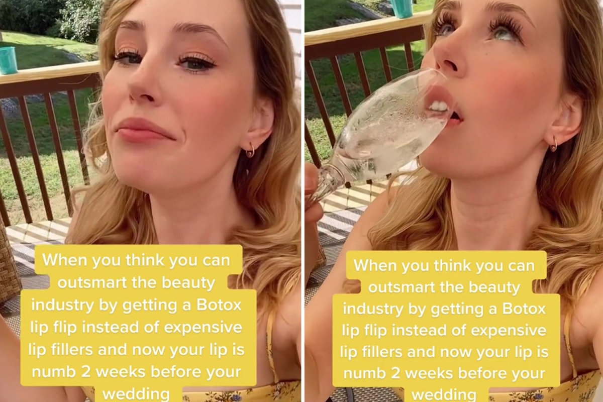 I got a Botox lip flip before my wedding so I didn’t have to pay for filler… my was mouth numb and I couldn’t drink