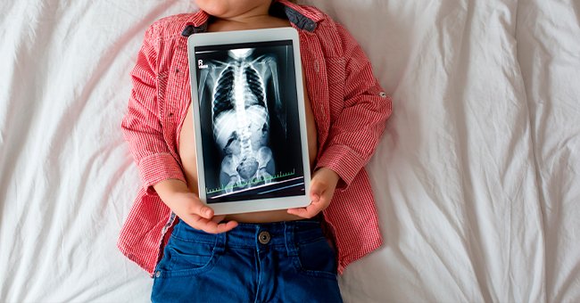 Blond boy holding an x-ray image | Source: Shutterstock