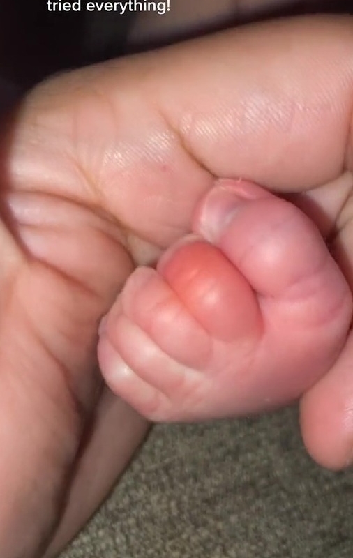 Mum warns parents to check babies’ fingers & toes or they could lose them after realising why tot wouldn’t stop crying