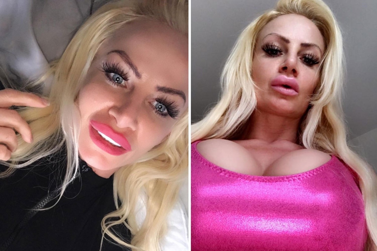 Mum who has spent £300k becoming real-life Barbie ‘threw a COMPUTER SCREEN at nurses in rampage of anger’