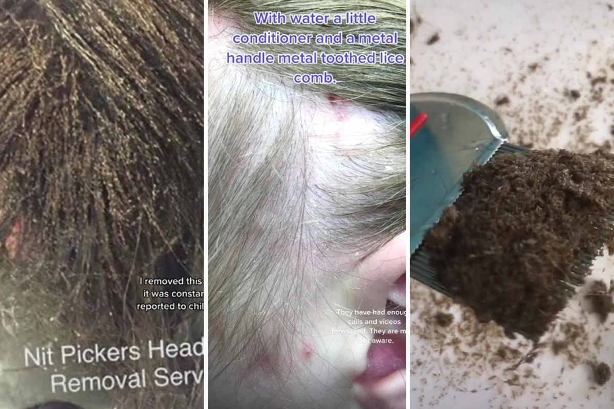 Professional headlice remover shares worst case she’s ever seen and admits head was so bad she wishes she’d WEIGHED it