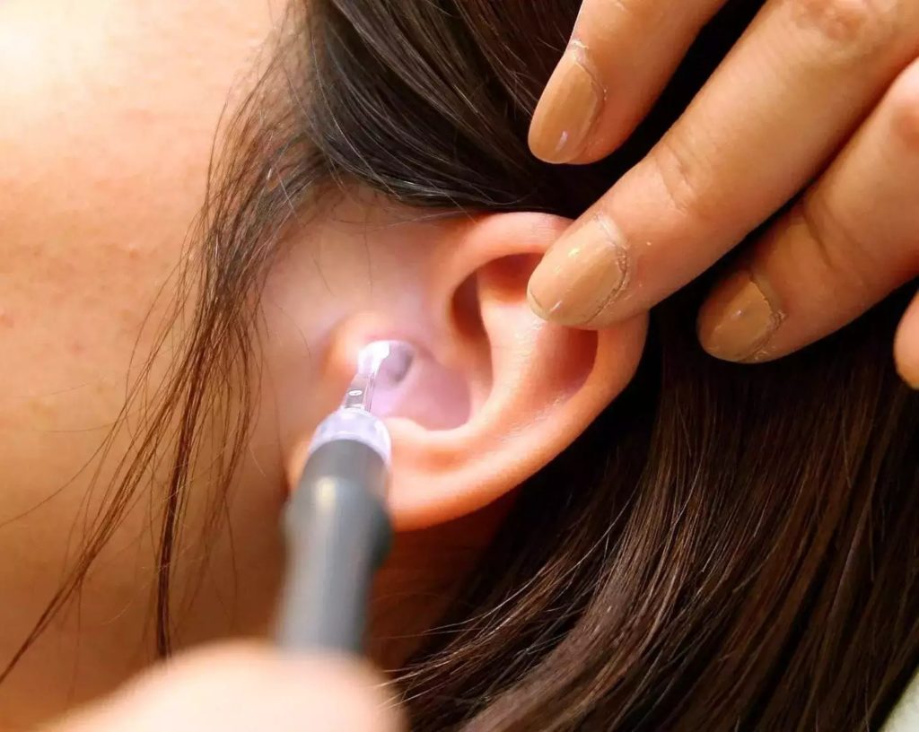 Here is the best way to Clean your Ear.