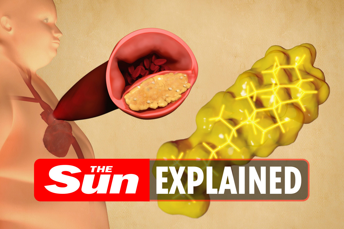 What causes high cholesterol, and how can we lower it? – The US Sun