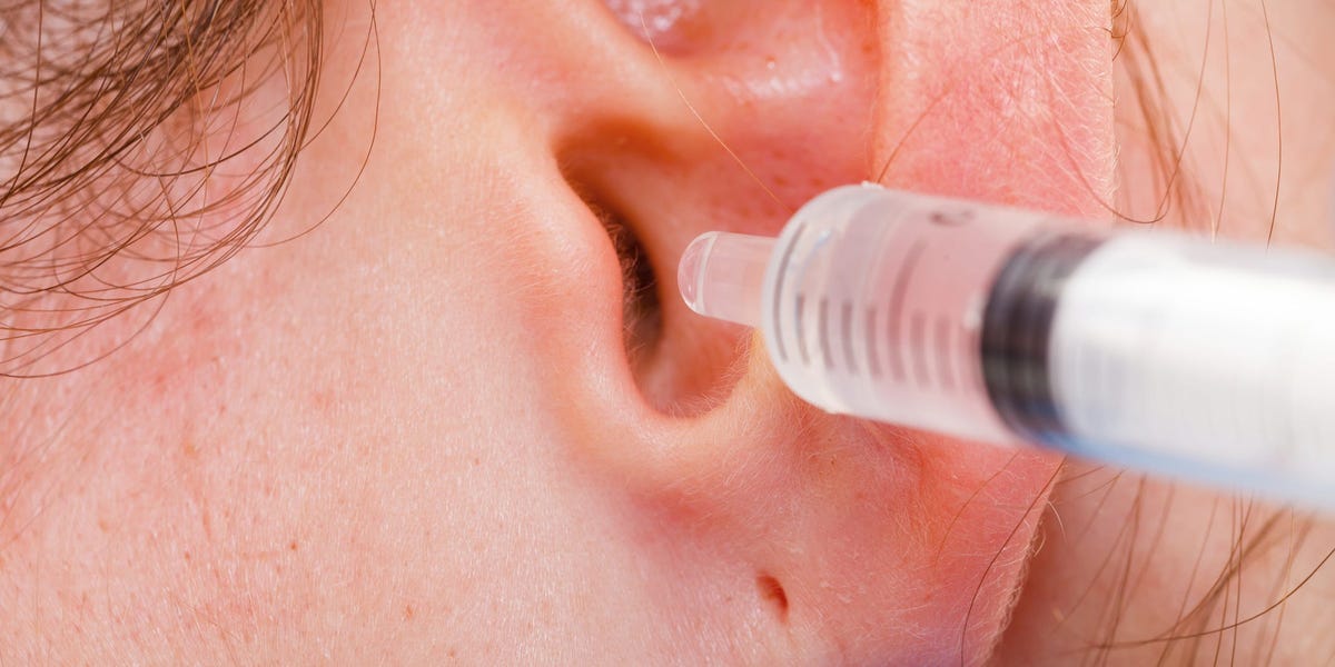 These are 3 safe ways to remove ear wax at home