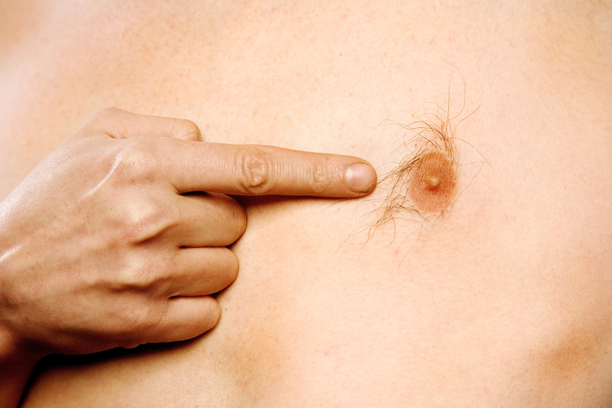 I’m a doctor and this is the strange place you never knew you had a NIPPLE