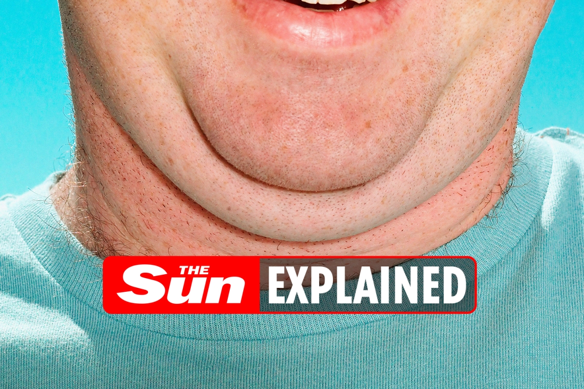 How do you get rid of your double chin? – The US Sun