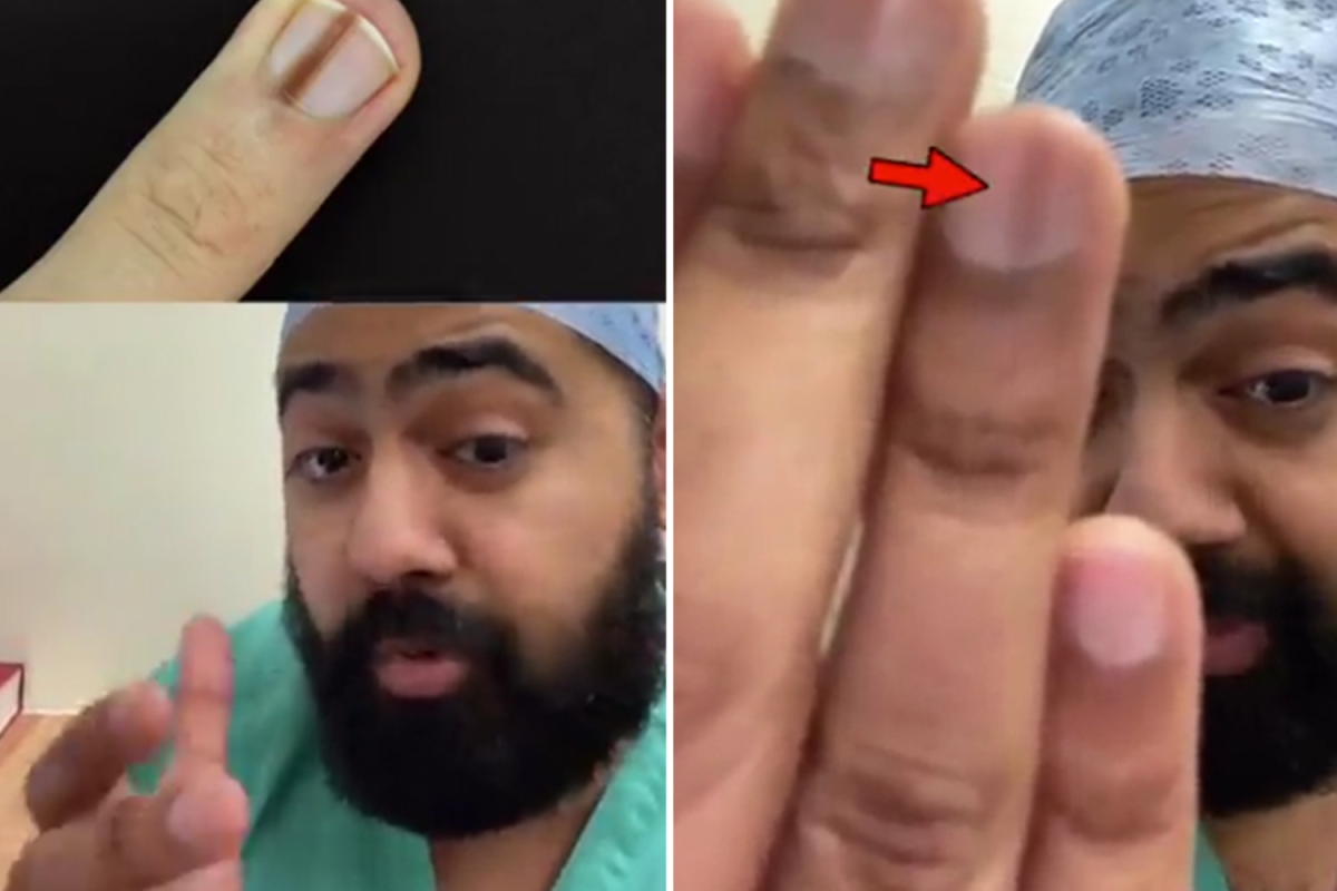 I’m a doctor and here’s the deadly signs on your fingernails you must NEVER ignore