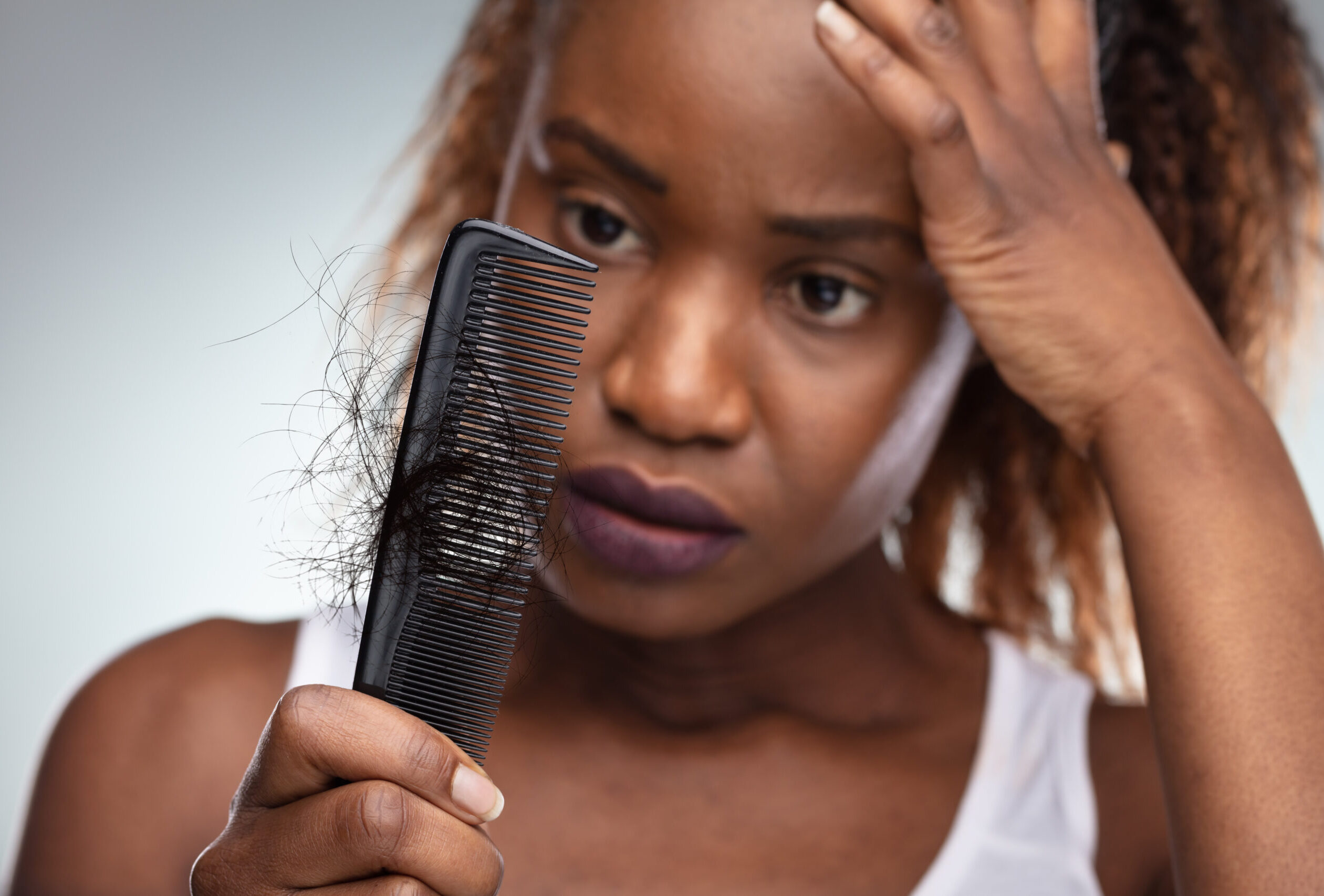 How Your Diet May Be Contributing To Hair Loss