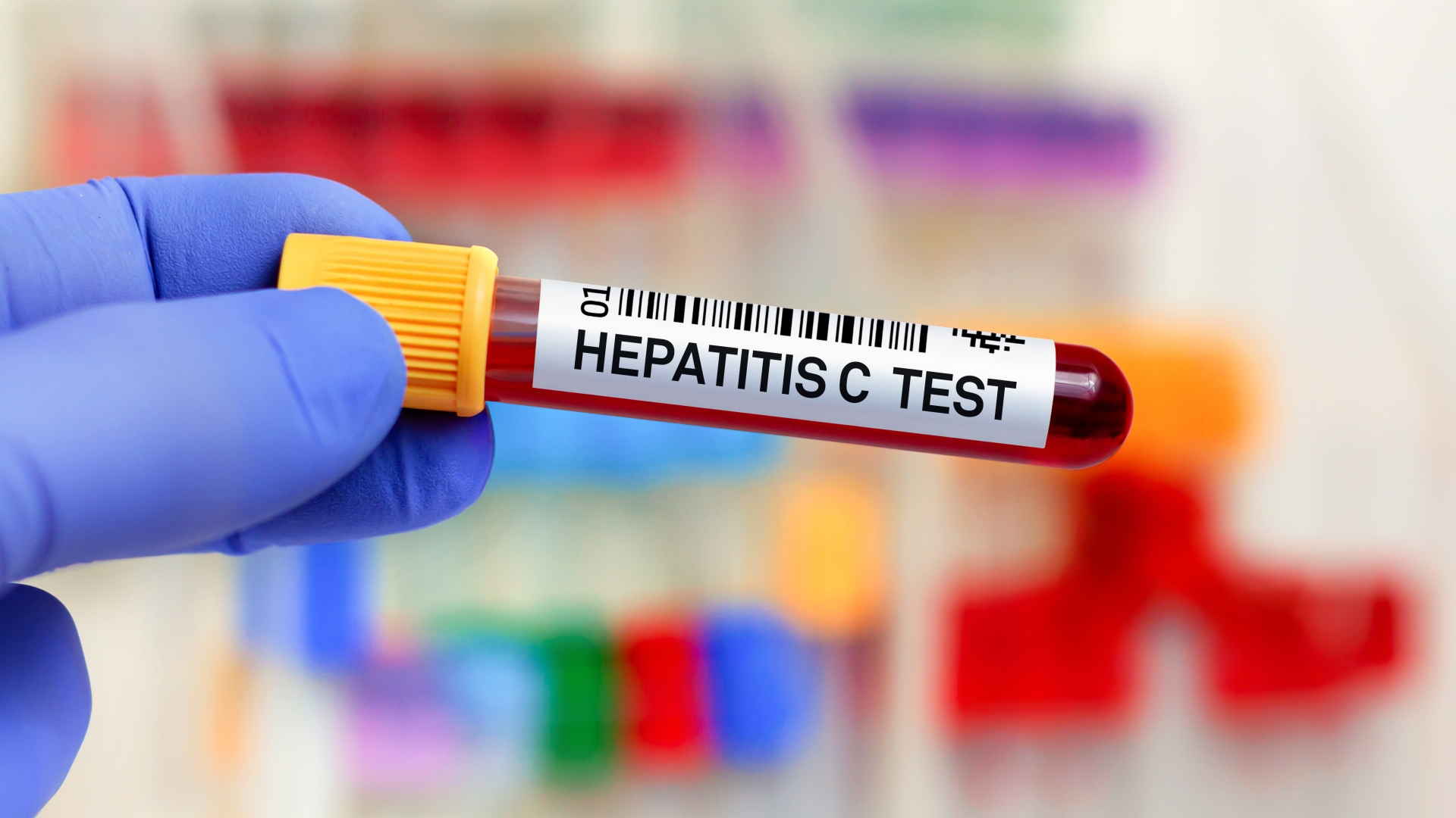 Urgent warning to parents as 11 more cases of mysterious hepatitis in kids confirmed