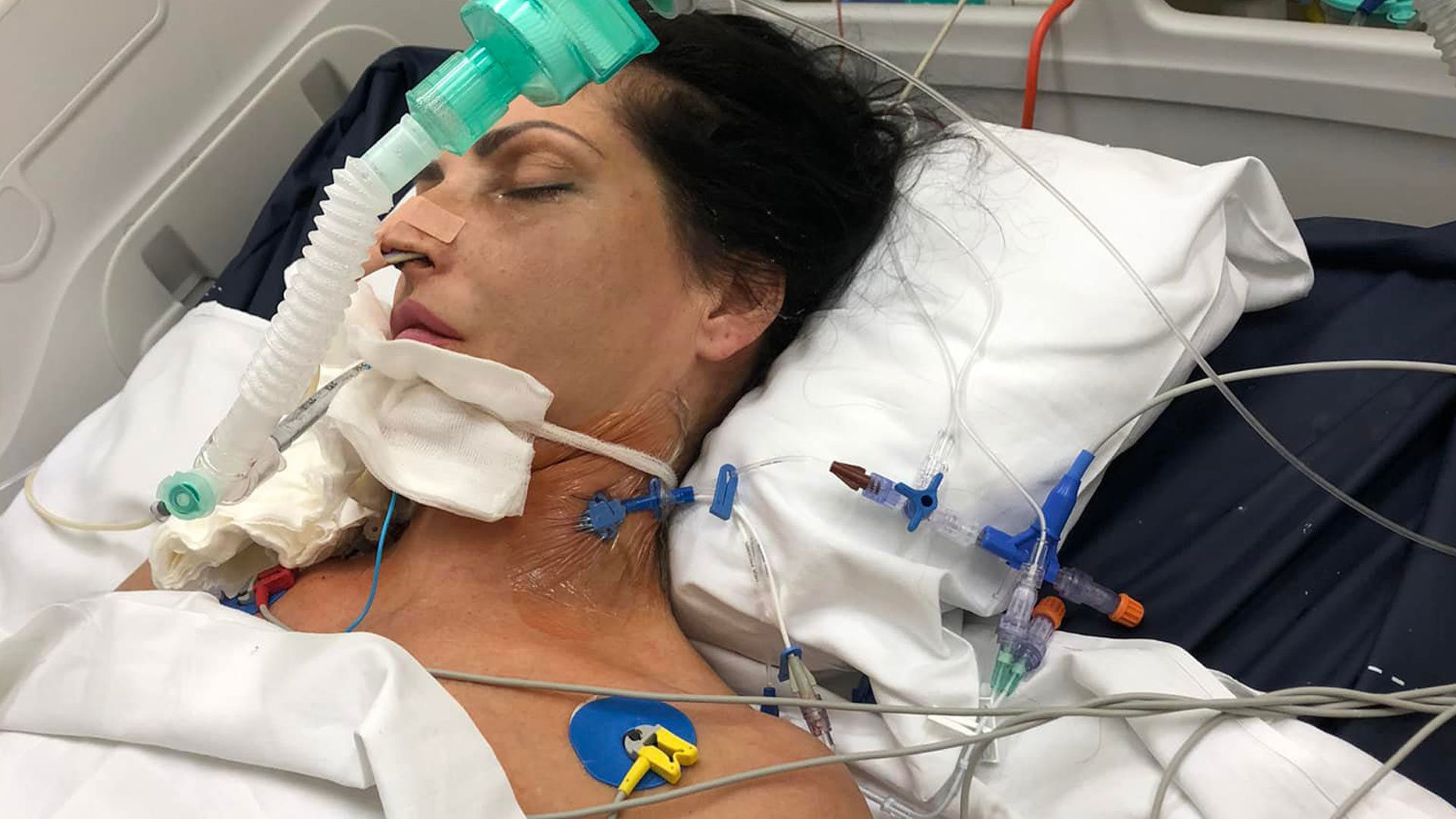 My sister’s botched £18k cosmetic surgery left her in a coma – she’ll never recover