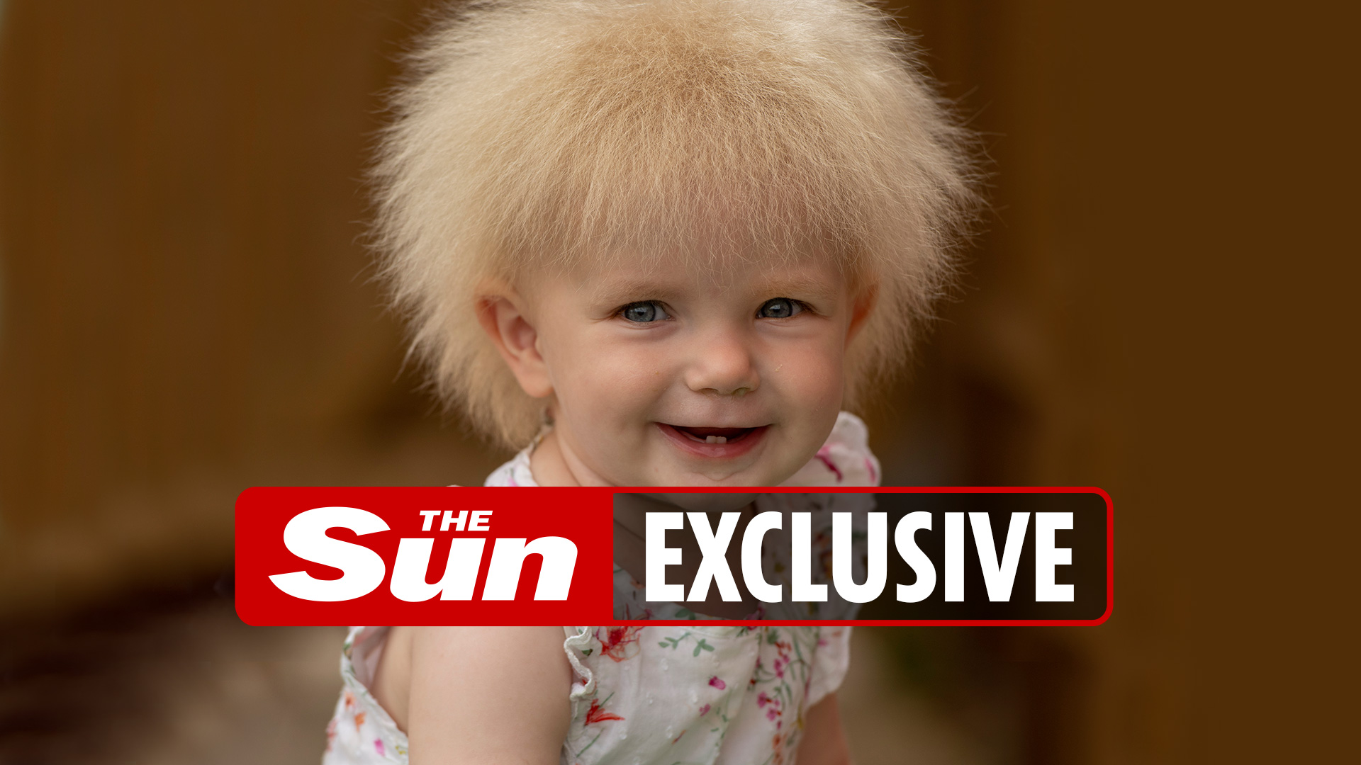 My little girl Boris Johnson looks like Boris Johnson. She has a rare condition that prevents her from having her hair combed.