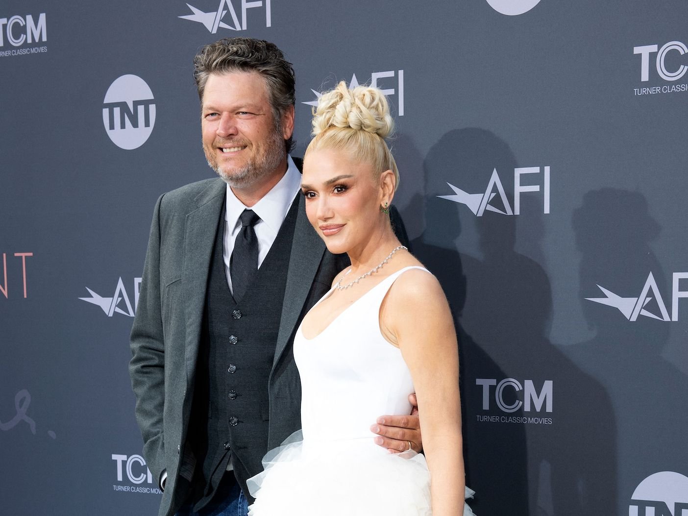 Sketchy Source Says Blake Shelton Supposedly Hates Gwen Stefani’s Plastic Surgery Obsession