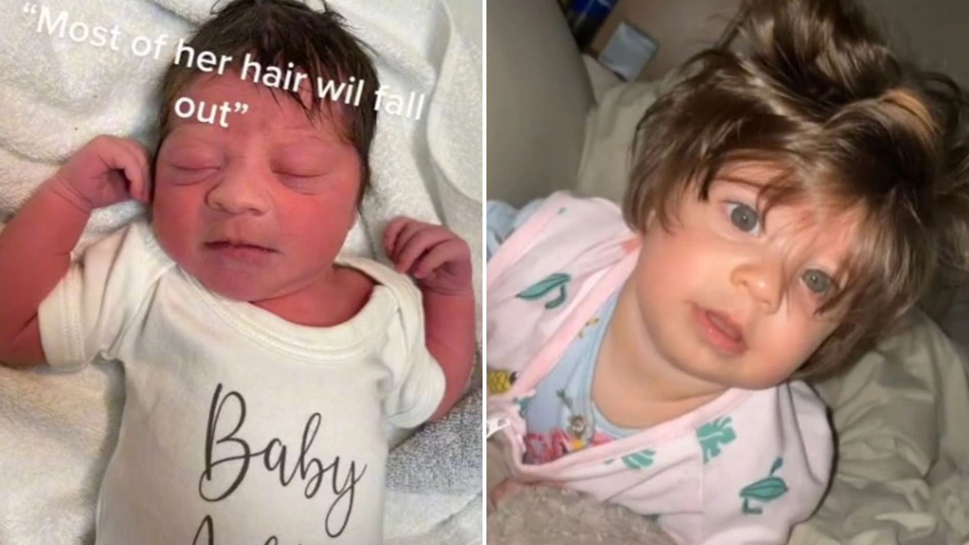I was told my baby’s hair would fall out by 6 months but now people say she looks like a Stranger Things heartthrob