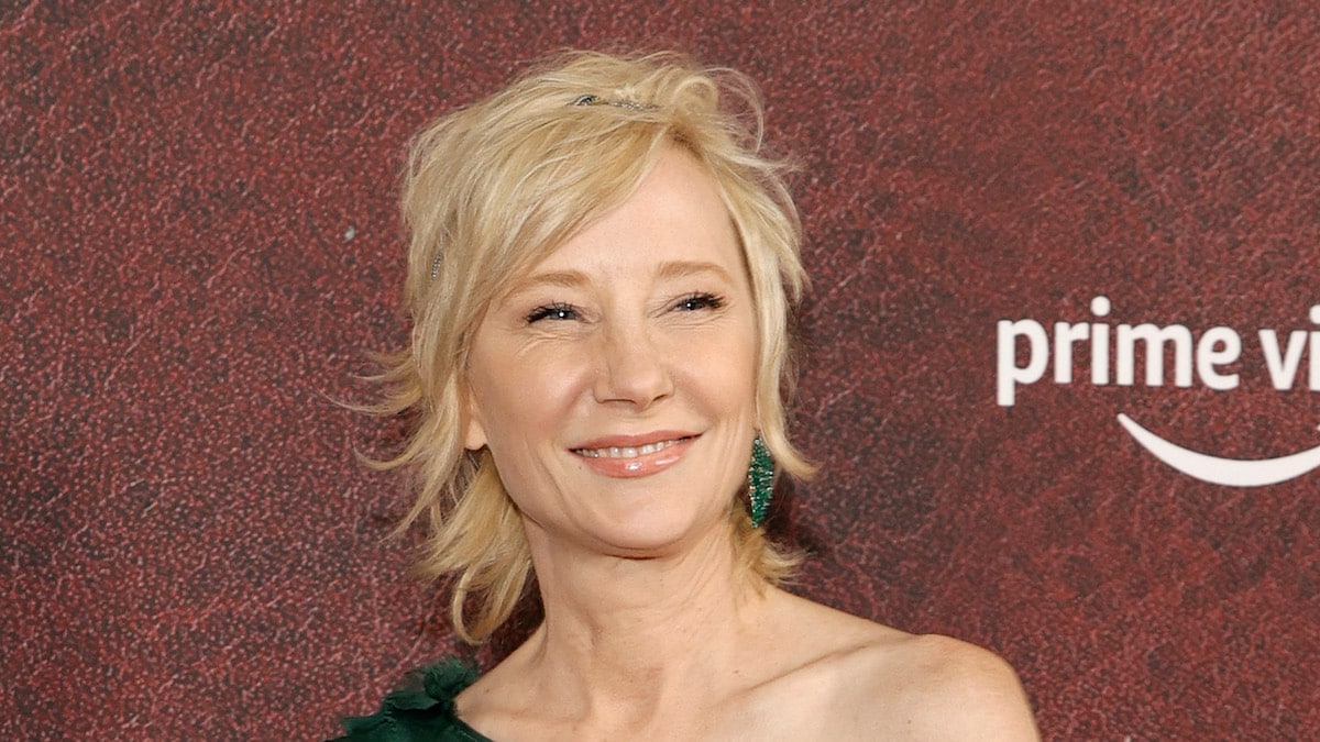 Representatives say Anne Heche is ‘not expected to survive’ due to severe brain injury