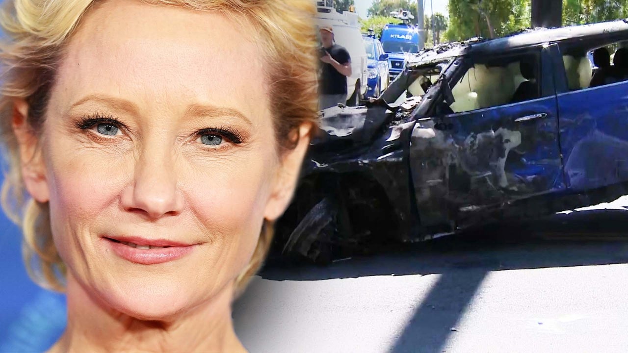 Anne Heche is under investigation for DUI, Hit and Run and after smashing her car into Los Angeles home
