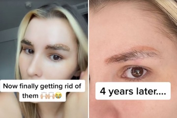 Woman urges others NOT to get eyebrows microbladed & shows results 4 years on
