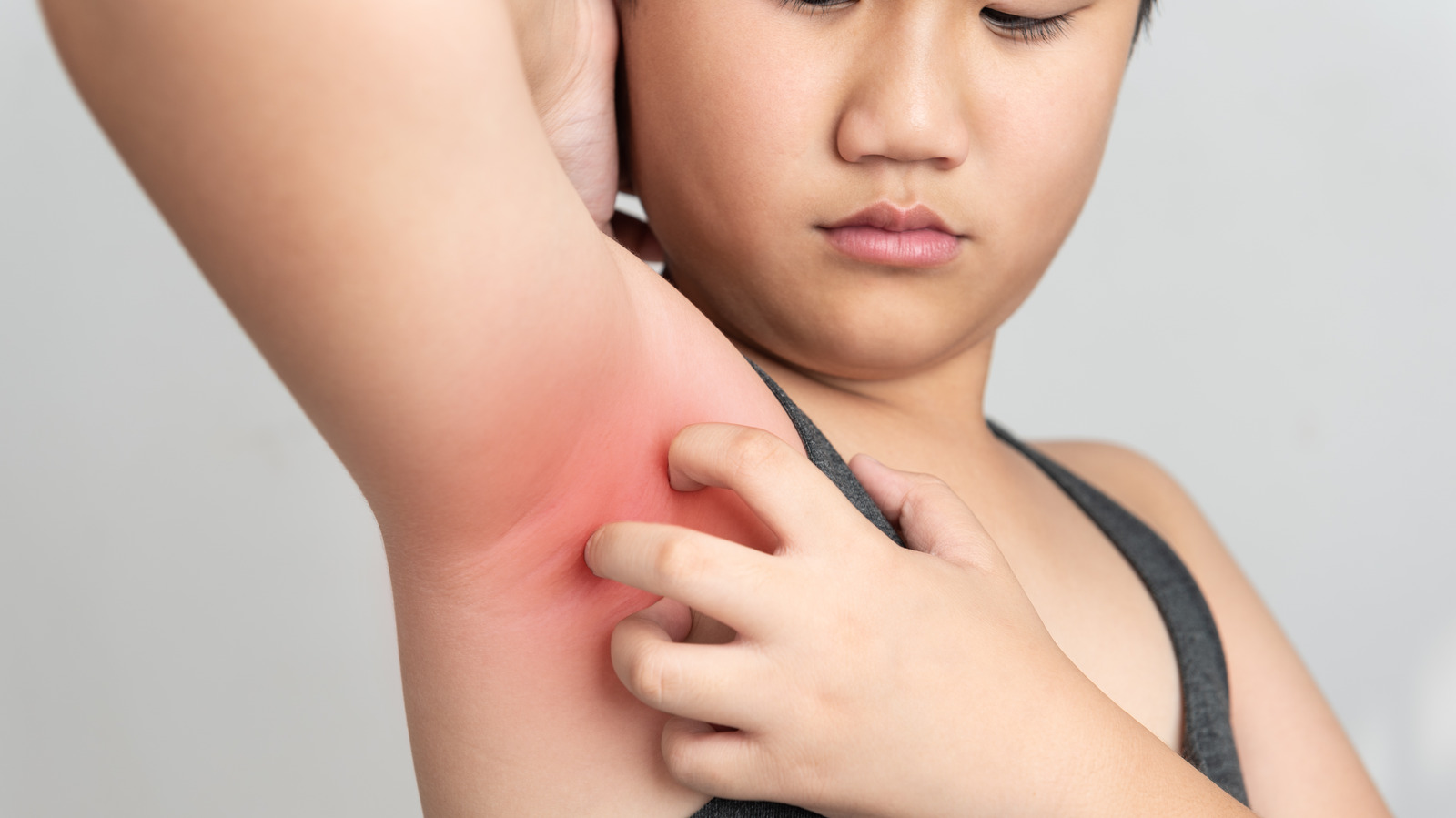 You may have allergic contactdermatitis in your armpits
