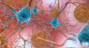Scientists track brain cell death to find early warning signs of deadly Alzheirmer’s.