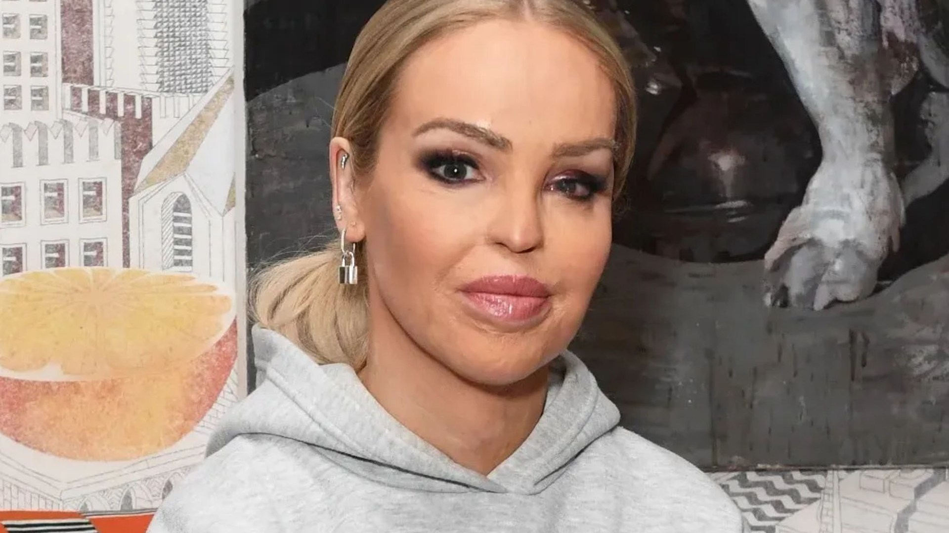 Courageous Acid Attack Survivor Katie Piper Donates £1,000 to Support Mother Injured in Clapham Attack