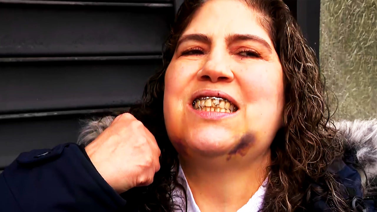 Shocking: NYC Woman Loses 3 Teeth in Random Assault by Stranger