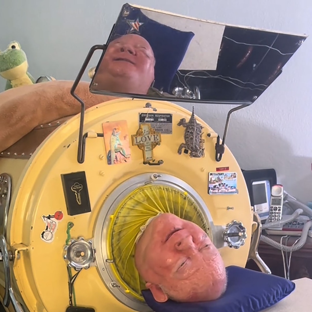 Unbelievable: Meet Paul Alexander, the Man Who Defied Odds Spent 70 Years in an Iron Lung Until Death at 78